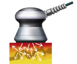 キャビテーションとは|AromaHealing Luxe