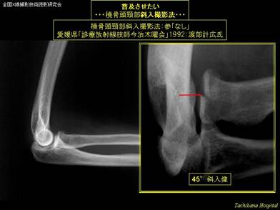 普及させたい撮影法：教科書や撮影技術本に掲載して欲しい撮影法