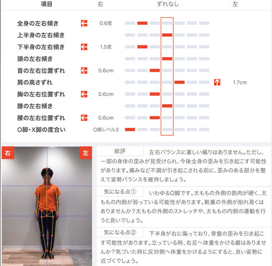 検査について｜神経学×姿勢分析×AI評価｜アールカイロプラクティック