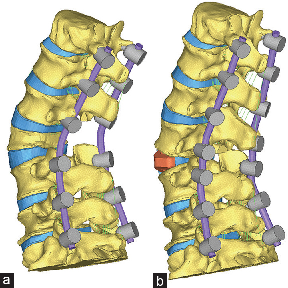 Surgical Neurology International