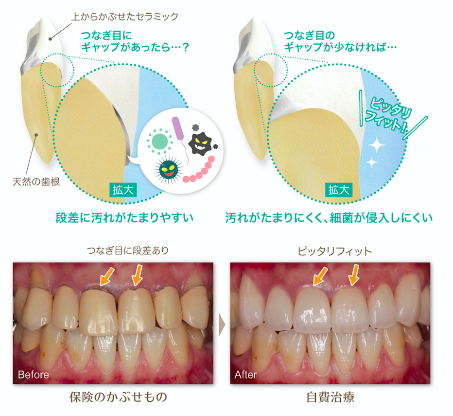 審美歯科 - 沼津市の歯医者・歯科【塚本歯科クリニック】歯周病専門医