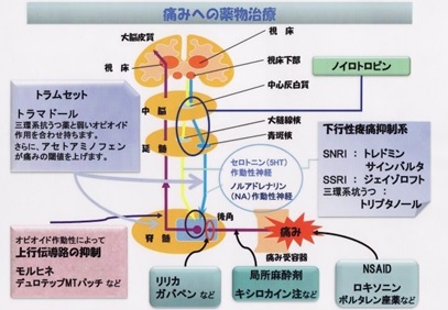 慢性疼痛に対する薬物療法 - はまな整形外科クリニック - 愛知県岡崎市