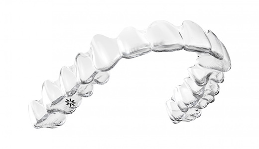 マウスピース矯正（インビザライン）｜阿倍野区のひらやま歯科クリニック