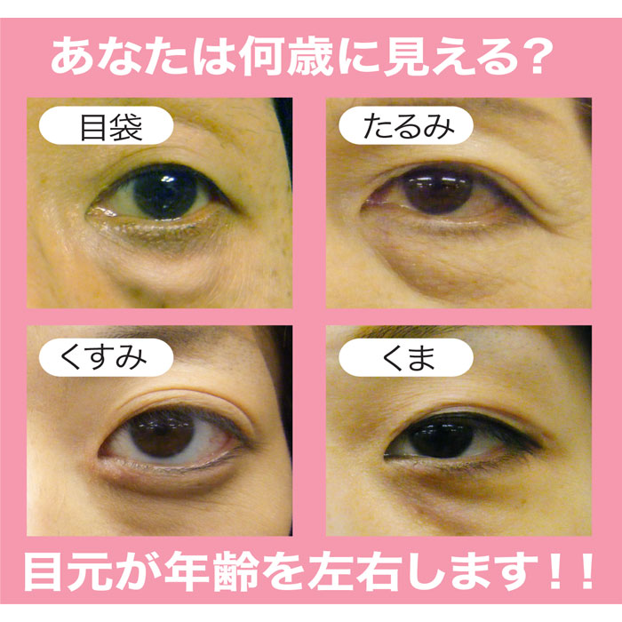 楽天市場】☆20%OFF☆【おまけ付】アイスラッククロフィートNEO (粘着