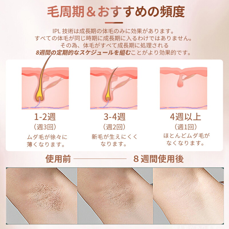 楽天市場】【YAMANGU】脱毛器 永久脱毛 IPL光脱毛器 家庭用脱毛器 光