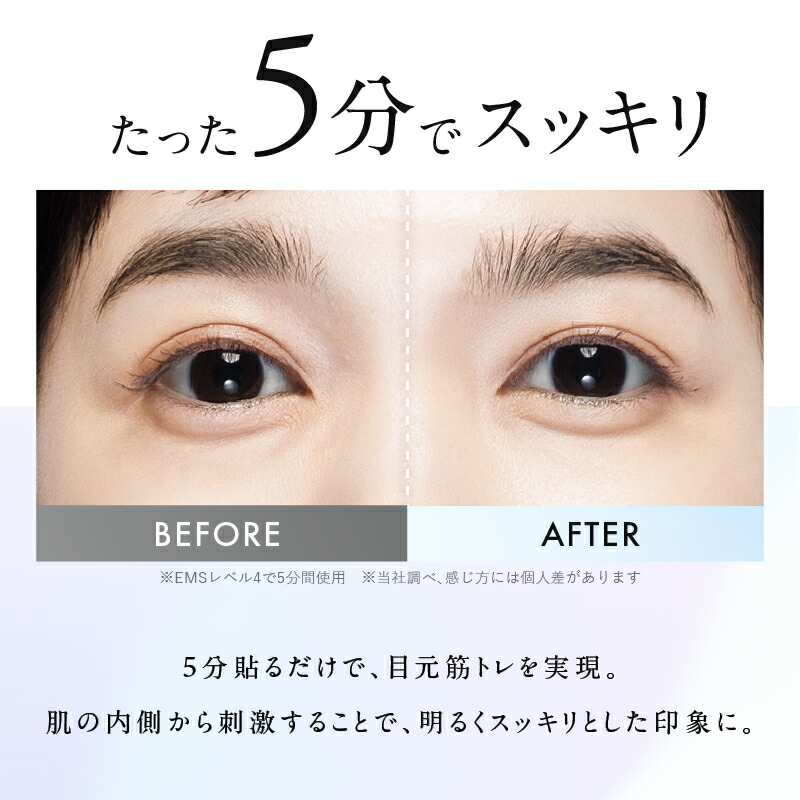 楽天市場】【30%OFFクーポン】NIPLUX ニップラックス EMS EYE LIFT