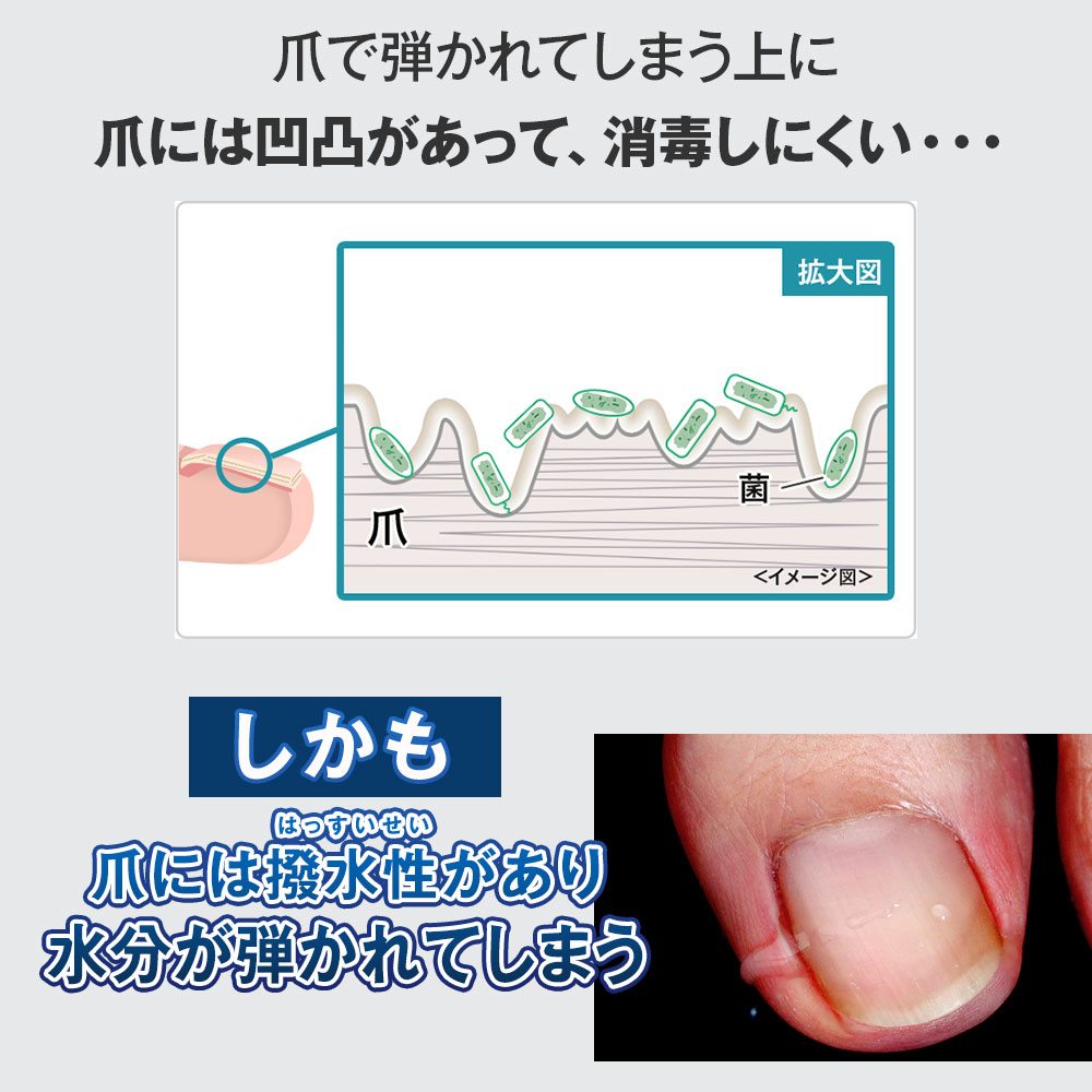 楽天市場】☆3個セット【爪周り 薬用 ジェル】『クリアストロング