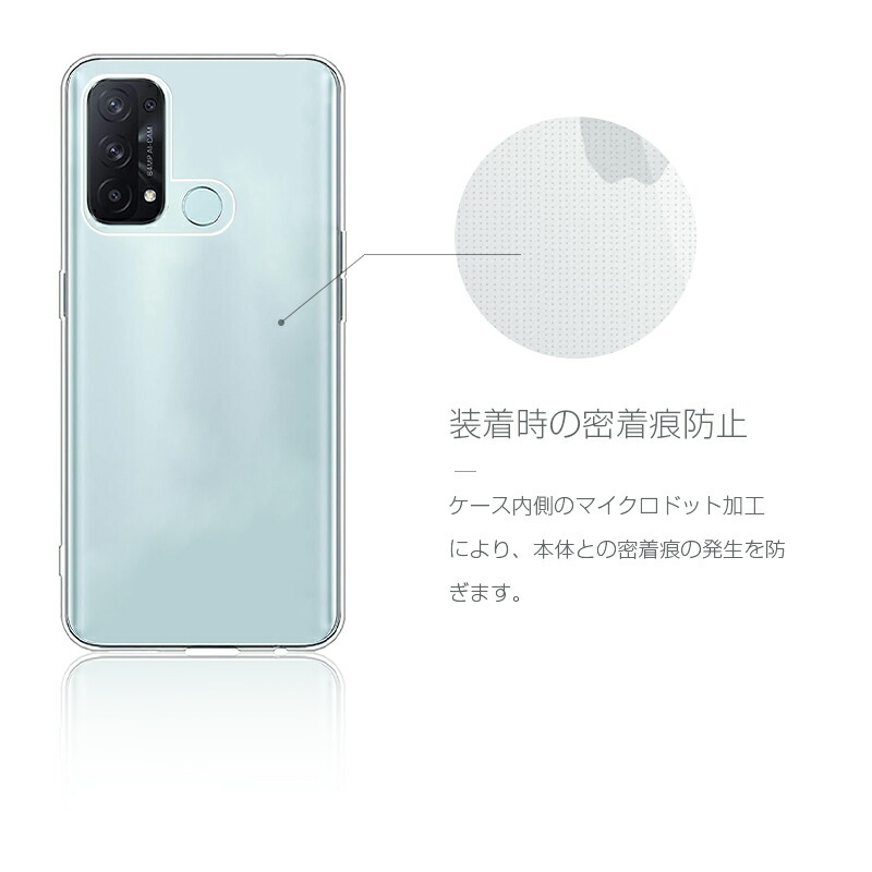 1109c14.jpg?fitin=720:720