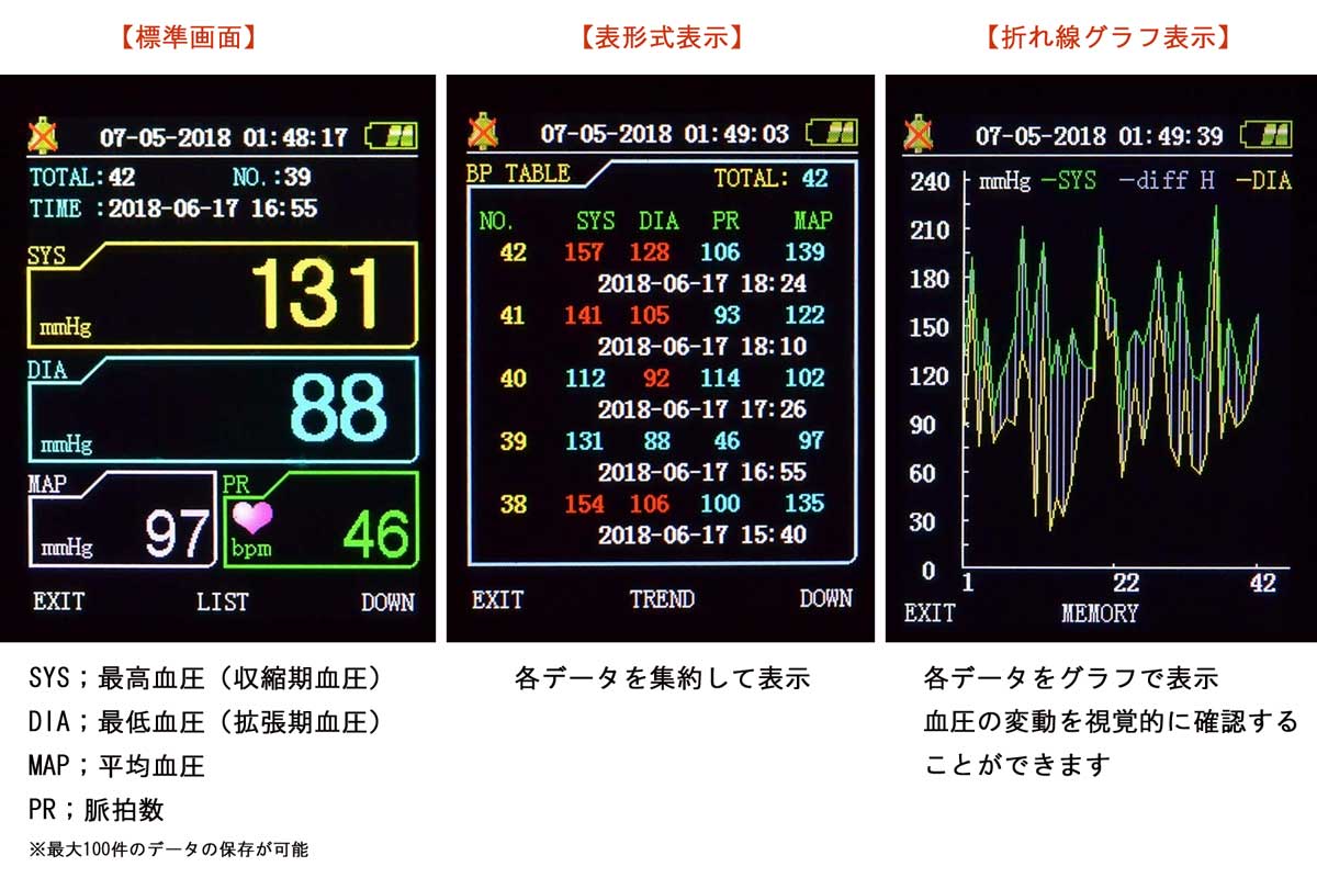 楽天市場】ペット血圧計 PES-1700 ERDE エルデ 犬 猫 動物 一般医療