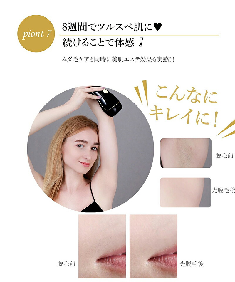 楽天市場】【半額以下】Y-KINZ 脱毛器 光美容器 光脱毛器 光エステ