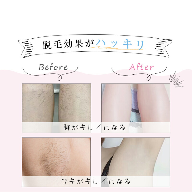 IPLフラッシュレーザーデポ ピンク IPLフラッシュレーザーデポ ピンク