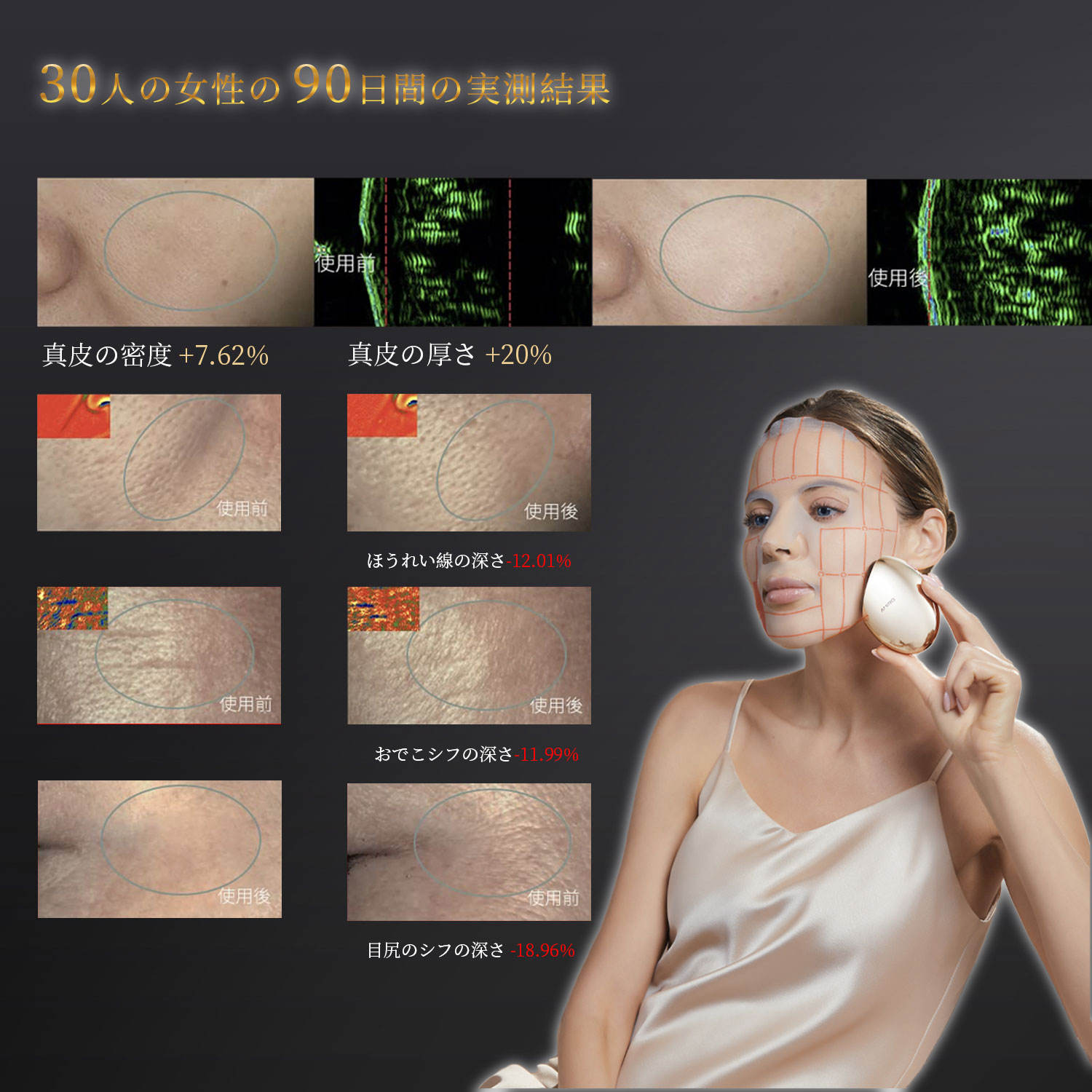 楽天市場】「時間限定ポイント10倍！1年間保証]AMIRO 最新 RF美顔器