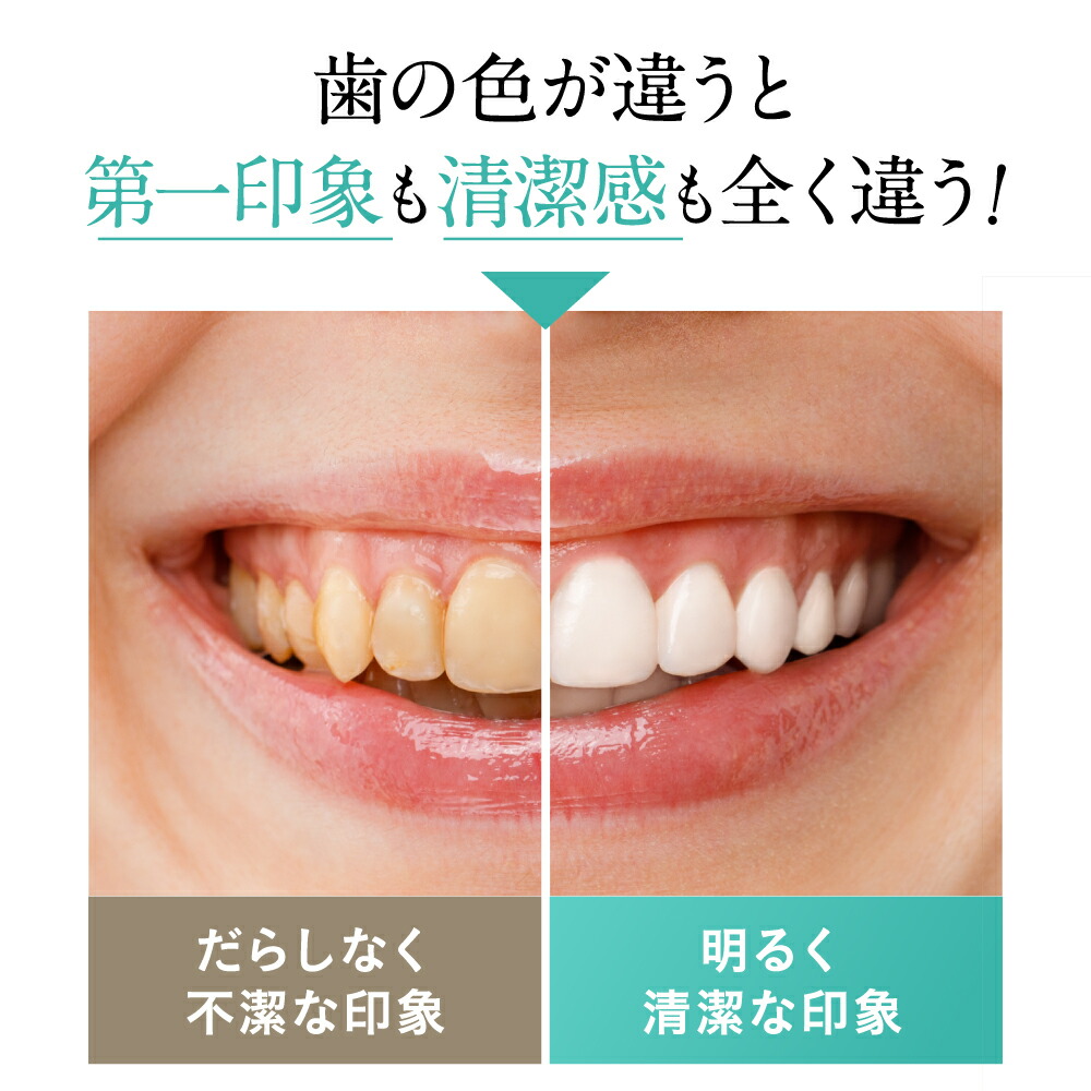 楽天市場】ホワイトニング 歯磨き粉 【 siroshu シロッシュ 】1個15g×3