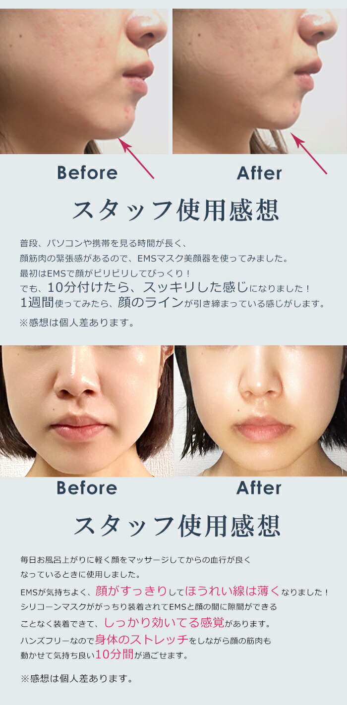 楽天市場】NEWタイプ 美顔器 ems ギフト対応 リフトアップ 小顔 目元