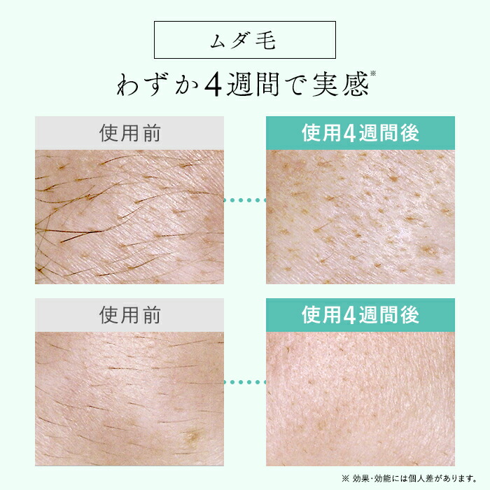 楽天市場】【20,000円OFFクーポン利用で68,000円⇒48,000円！】IPL&LED