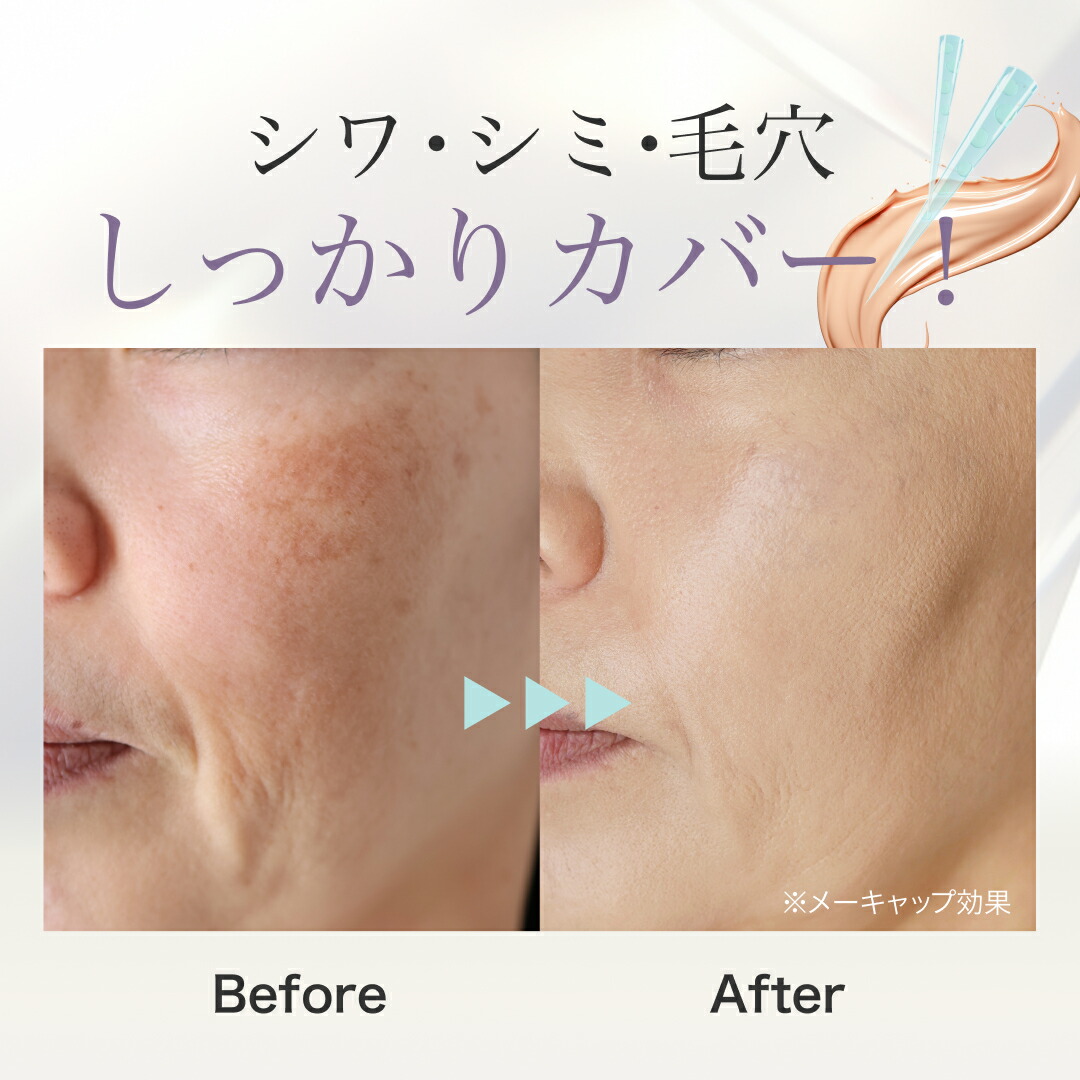 楽天市場】【公式】lujo ニードルクッションファンデーション 針