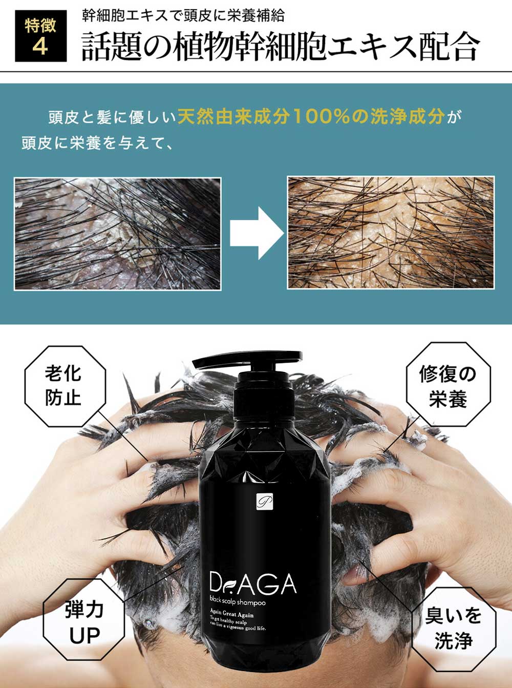 楽天市場】幹細胞入 Dr.AGA ブラックスカルプシャンプー【大容量500ml