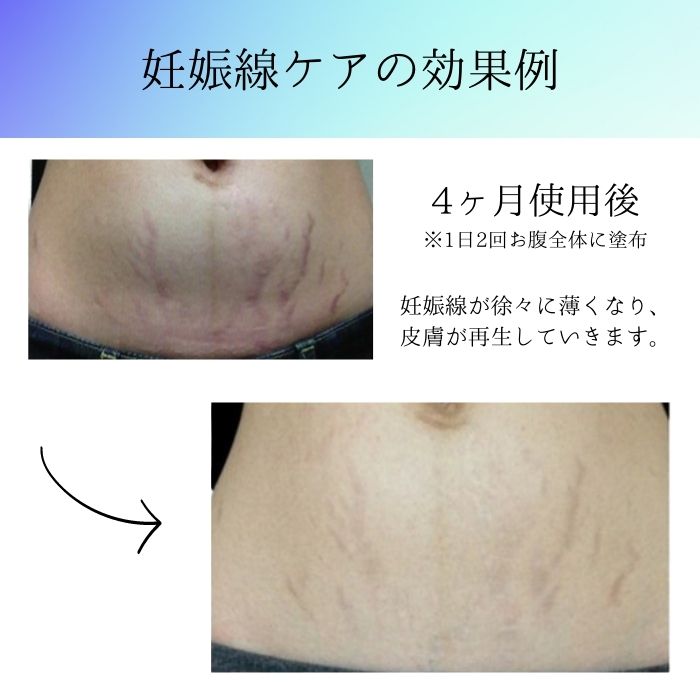 楽天市場】【正規代理店】シルバースペース+ 80g SILVER SPACE+ 痛み