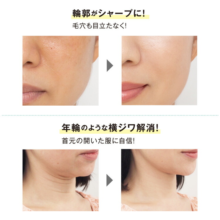 楽天市場】【送料無料】リフトアップテープ かづき・デザインテープ [5