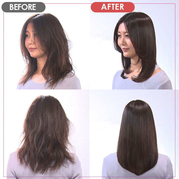 楽天市場】MEリカバリー プロ 特別セット ／ 超音波トリートメント導入