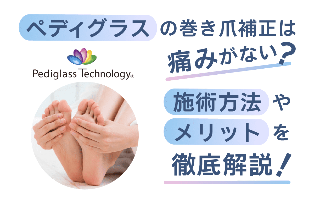 ペディグラス 巻き爪補正器具 (左10本／右10本) 計20本 【公式通販】