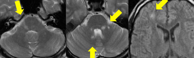 症例4：診断と解説