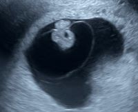 所見から探る産科超音波診断