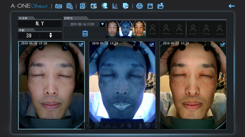 肌診断機器 A-ONE Smart上位機種（エイ・ワン・スマート）は販売終了
