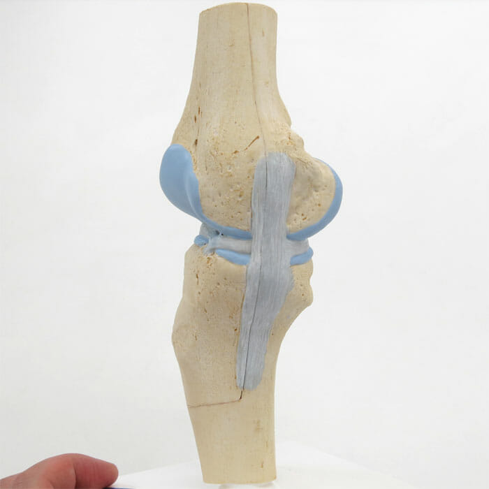 膝の関節断面，3分解モデル | 日本スリービー・サイエンティフィック