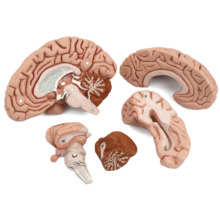 脳模型・神経模型・脳室模型｜3B Scientific