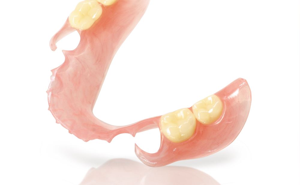 ノンクラスプデンチャー - 株式会社足利セラミックラボラトリー