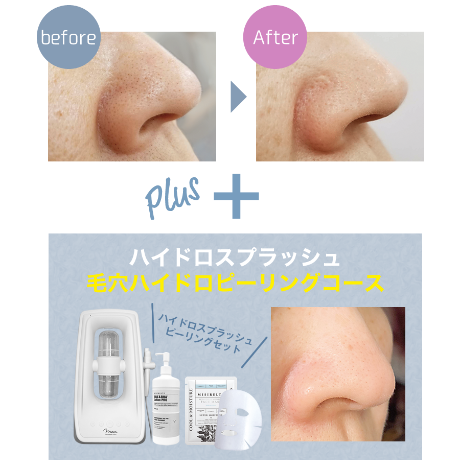 MISIRELTO AHA&BHAローション PRO 500mL-美容機器の卸/仕入れならビー