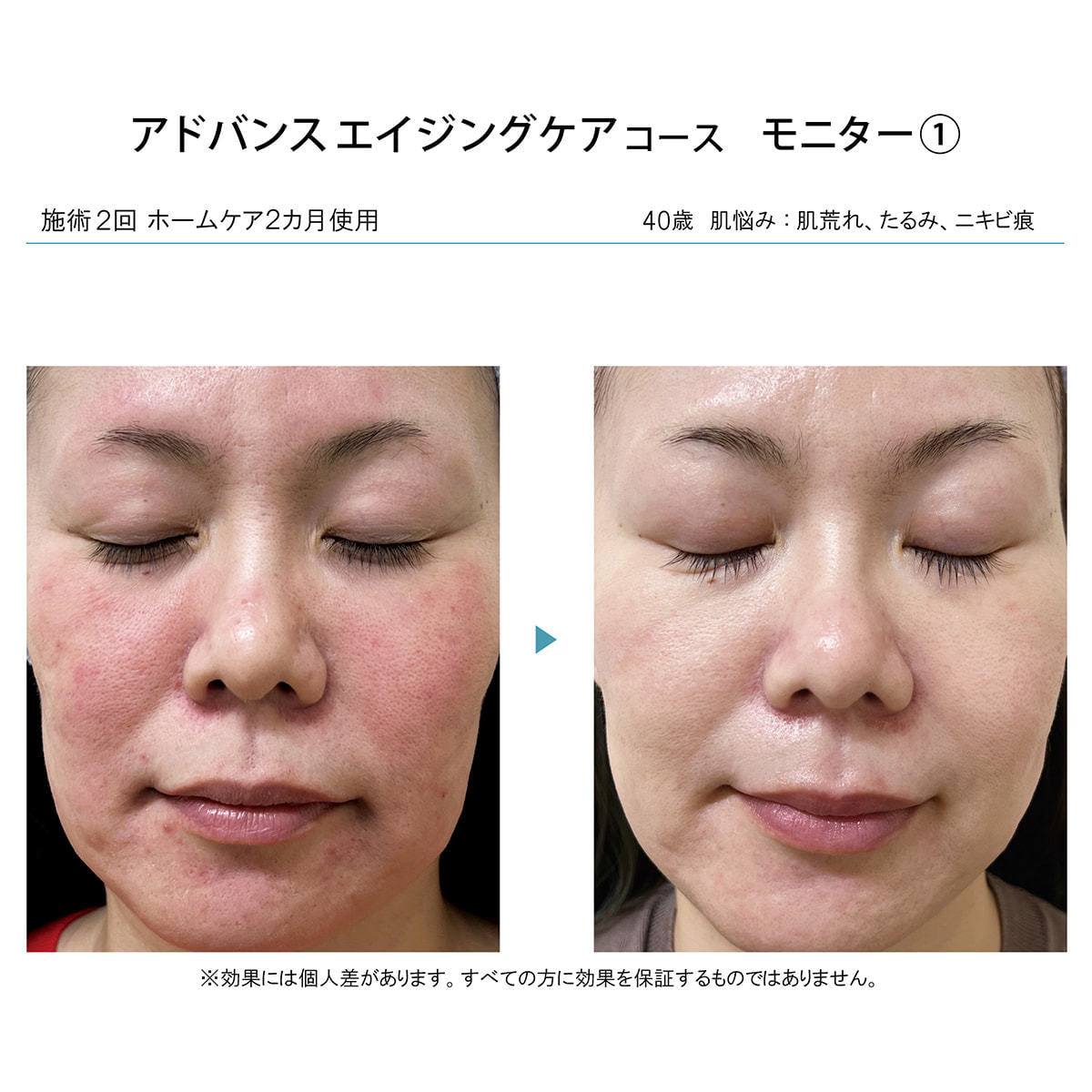 ラボプラス ADノーブル SPブーストエフェクト 50ml【店販用】の卸