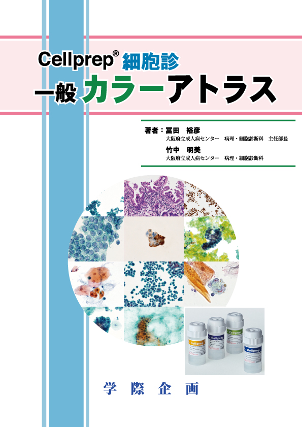 書籍】Cellprep®細胞診 一般カラーアトラス