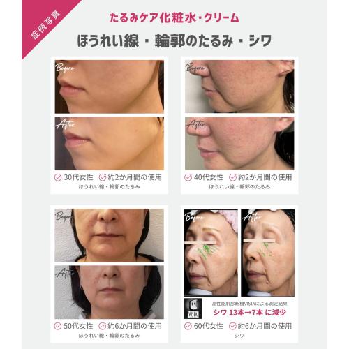 メディーナ F 2Wアクティブローション / DOCTOR EXPRESS ドクター