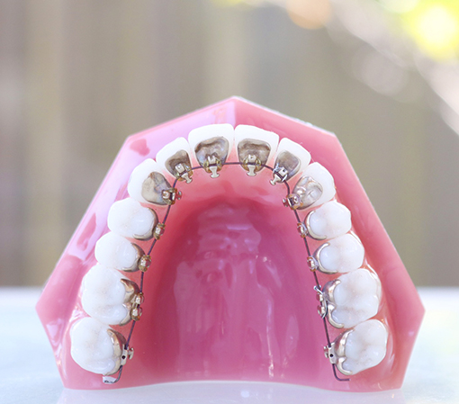 診療案内｜会津若松市東山町の歯医者｜山田歯科矯正歯科