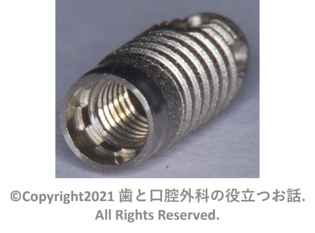 IMZ Implant TwinPlus Screw type | 歯と口腔外科の役立つお話