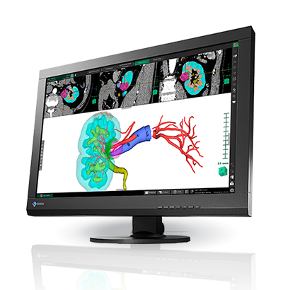 RadiForce MX242W 2.3MP Widescreen Monitor with DICOM | EIZO
