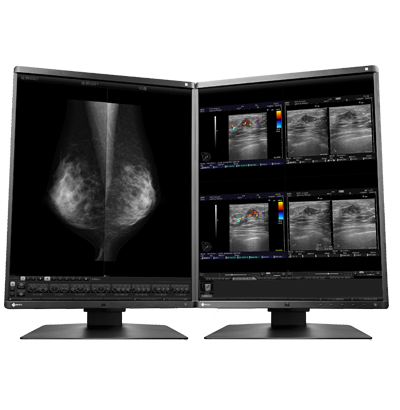 RadiForce RX560 5MP Medical Monitor with AR Coating | EIZO