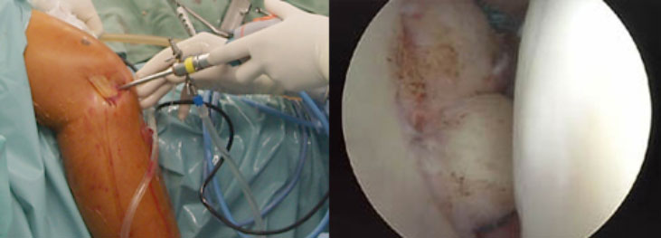 裁断済】膝関節鏡視下手術 膝関節鏡視下手術【電子版】 | 医書.jp