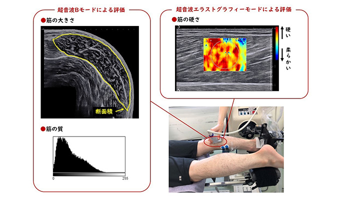 運動器理学療法分野 |関西医科大学