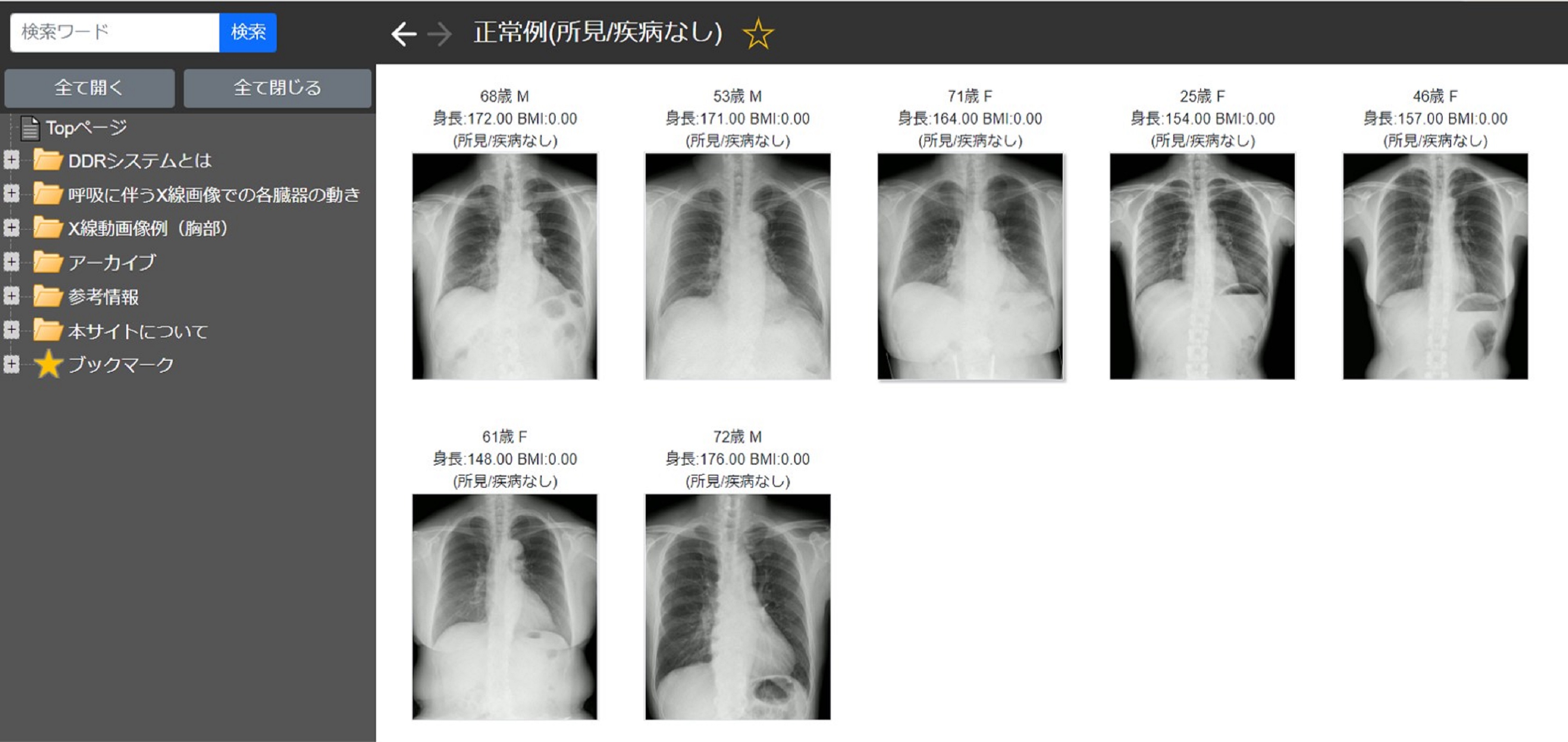 X線動画像のデジタル症例集「DDRAtlas Ver. 1.0」を公開 一般X線撮影