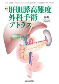 手術：最新 肝胆膵高難度外科手術アトラス：2016年03月号(70巻04号)の