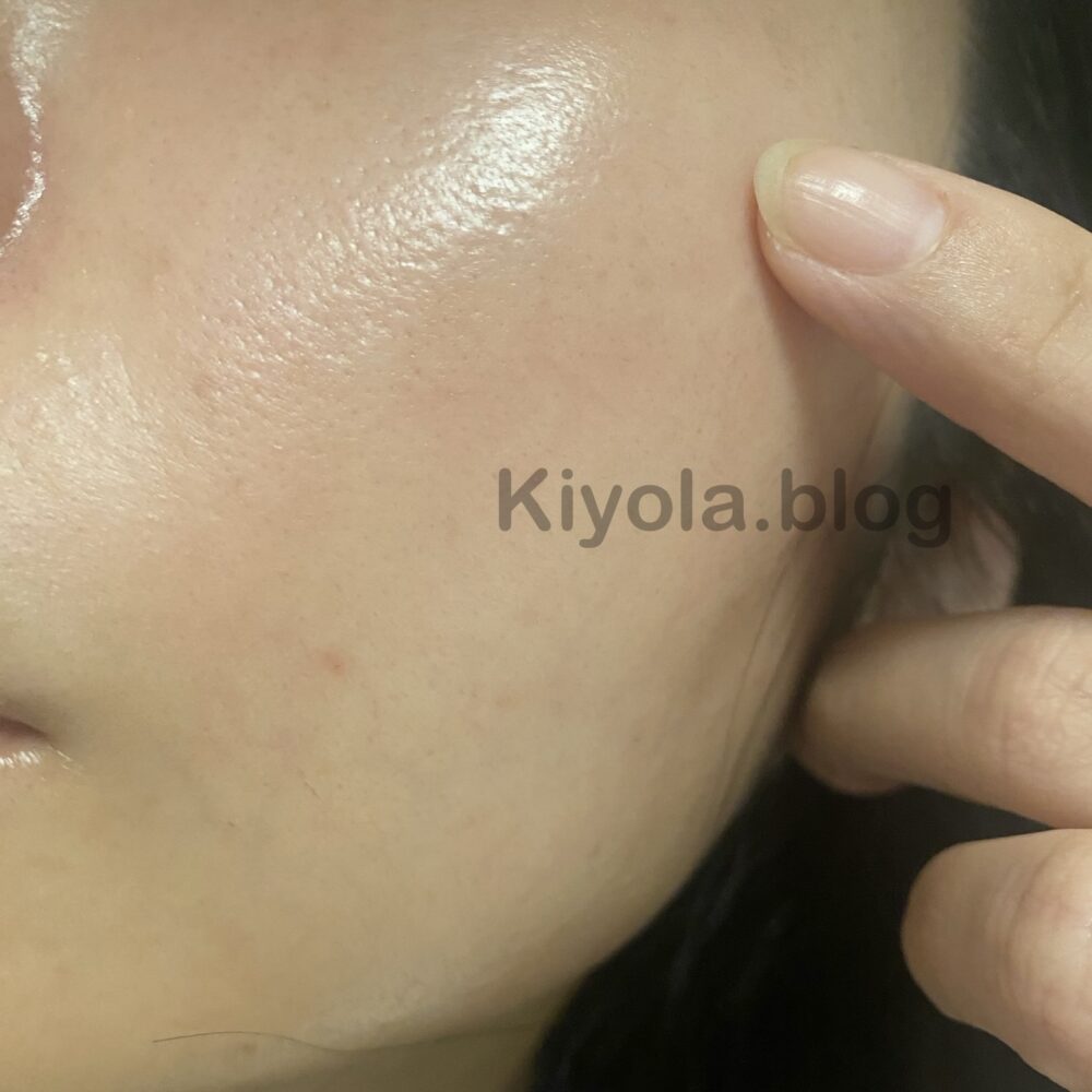 毛穴特化型美顔器ペンタショットは本当に効果ある？自宅でコツコツ3
