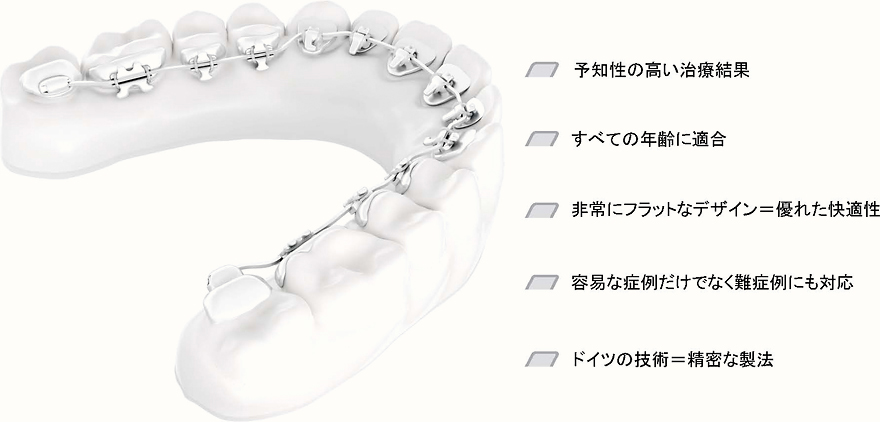 舌側矯正・裏側矯正｜熊本駅前矯正歯科クリニック