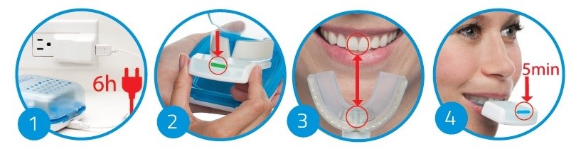 オルソパルス（光加速矯正装置）なら東京銀座ビアンコ矯正歯科