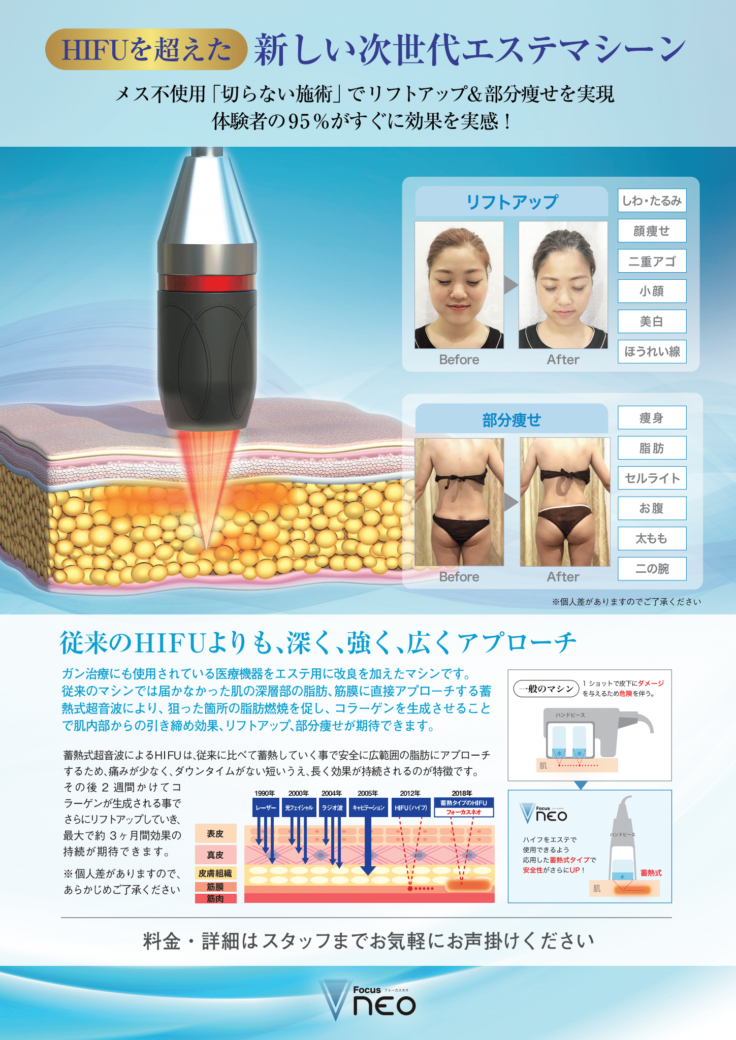 hair mode airish｜最新ハイフ｜フォーカスネオ