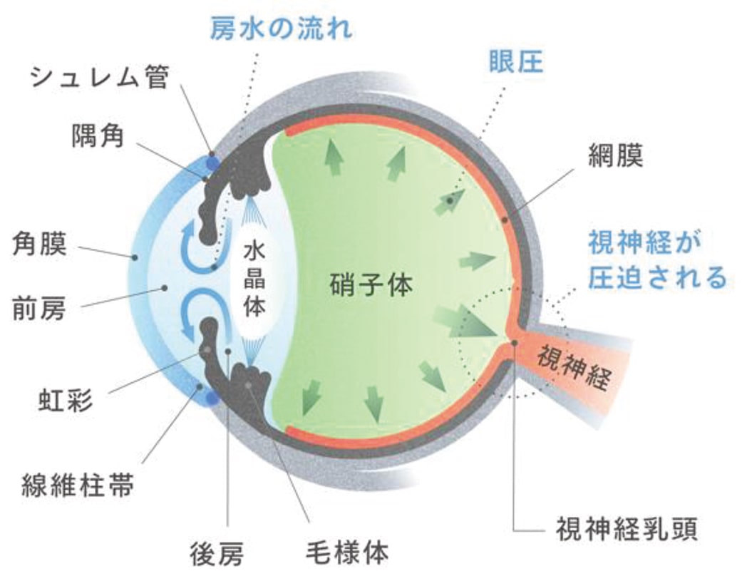 緑内障｜大和駅の眼科｜大和ハナミズキ眼科