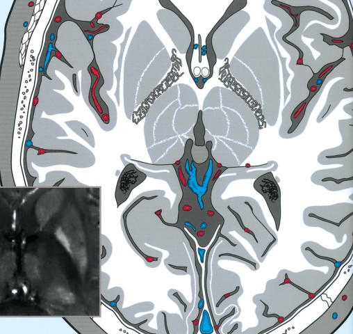 脳の機能解剖と画像診断 第2版 立ち読み
