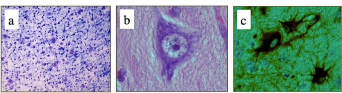 てんかん ｜ 身近な医学研究情報 ｜ 公益財団法人 東京都医学総合研究所